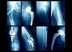 Medical & Orthopaedics